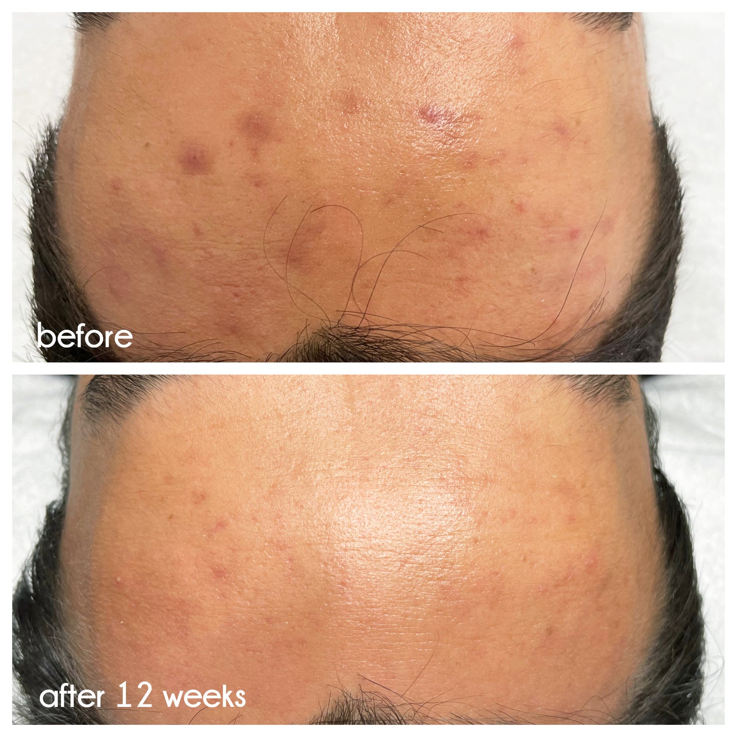 Clean Slate Serum