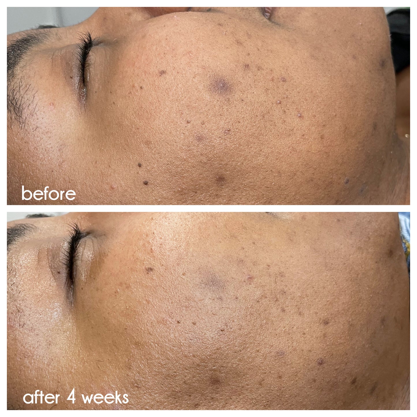 Clean Slate Serum