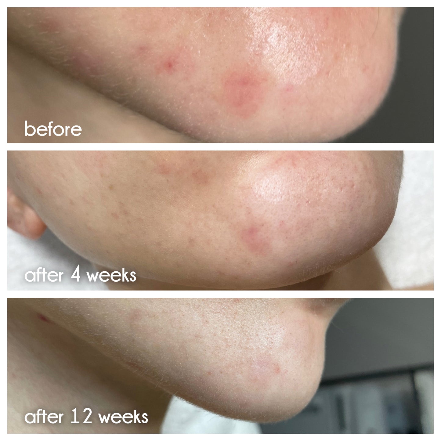 Clean Slate Serum
