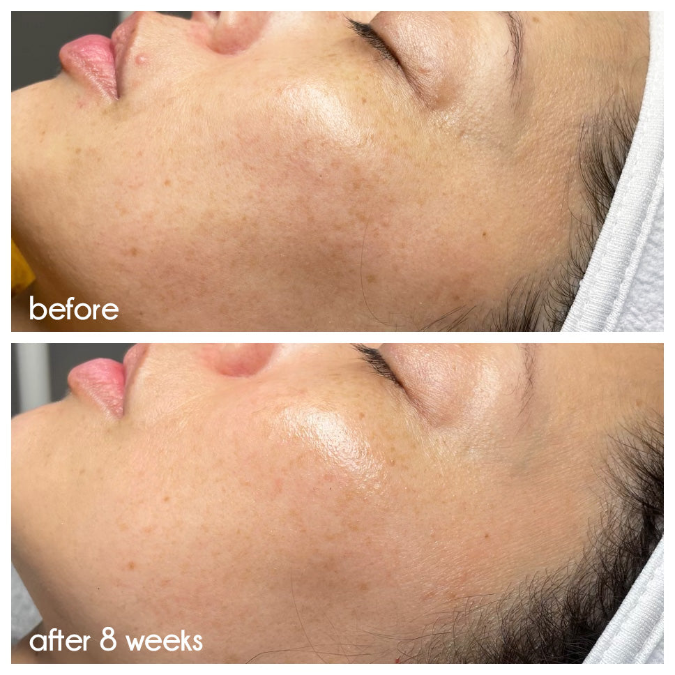 Clean Slate Serum